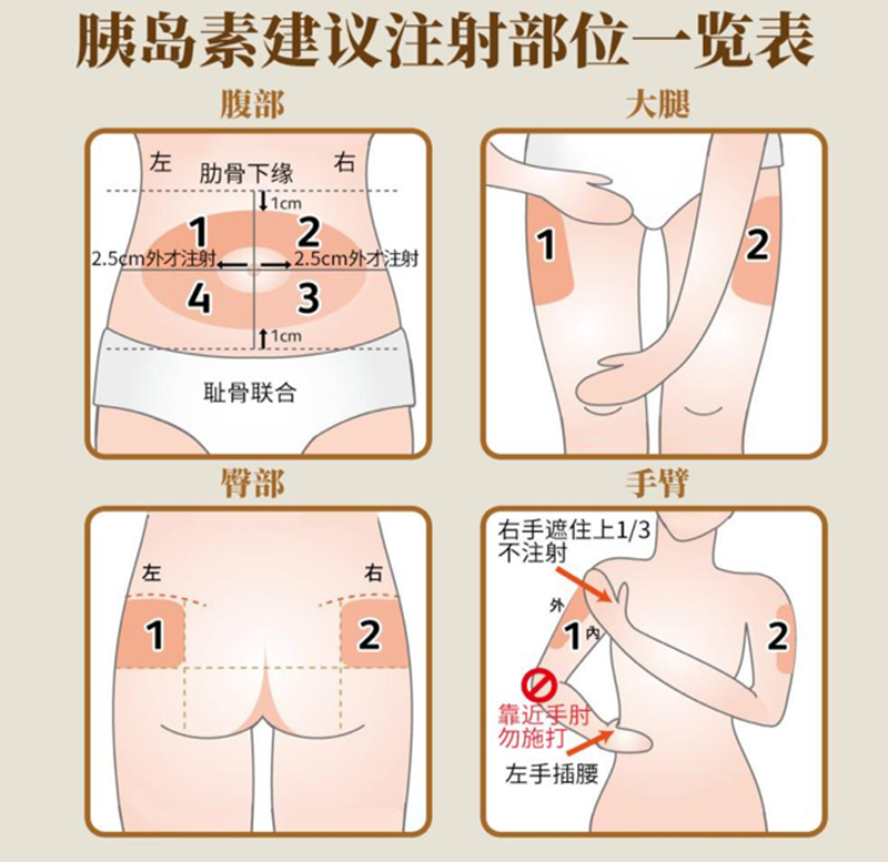 C:\Users\admin\Desktop\20230314胰島素注射\微信圖片_20230316134812.png